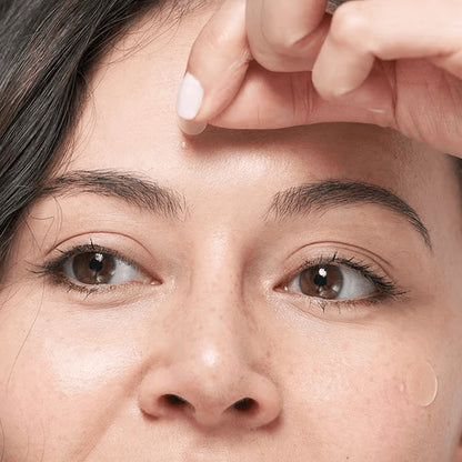 Skin Tag Removal Kit: All Natural & Hypoallergenic