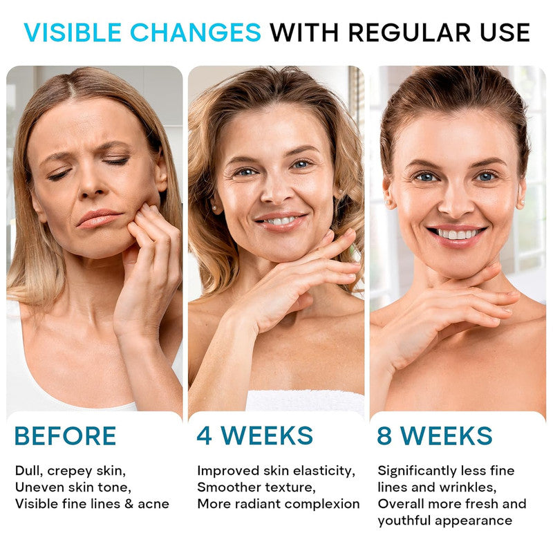 Face Moisturizer Retinol Cream, Anti Aging Wrinkle Remover with Collagen & Hyaluronic Acid Skin Care Cream